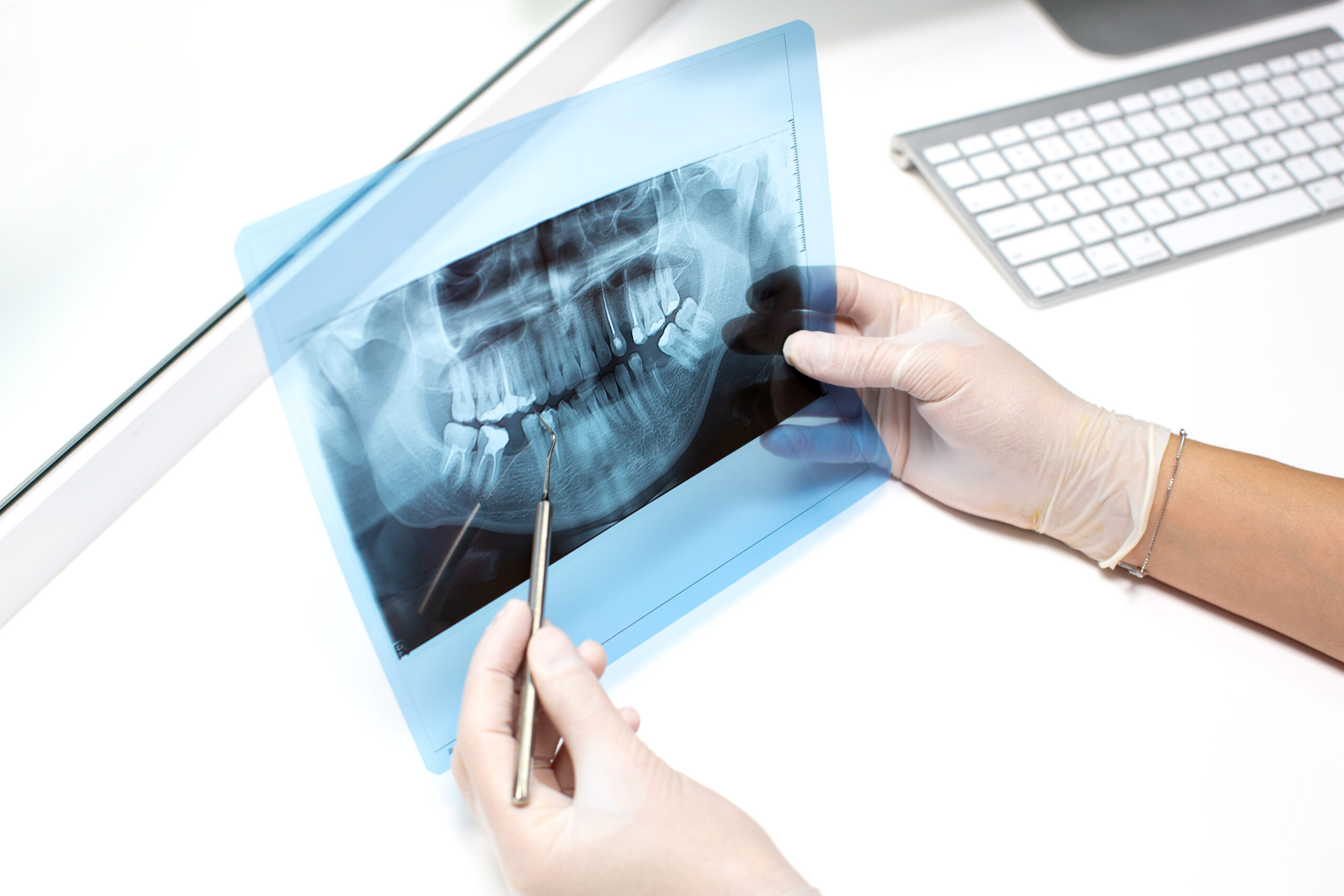 Stomatološka ordinacija Beograd - IV Dental Studio